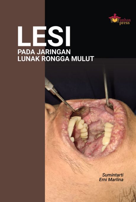 978-979-530-347-3_Front