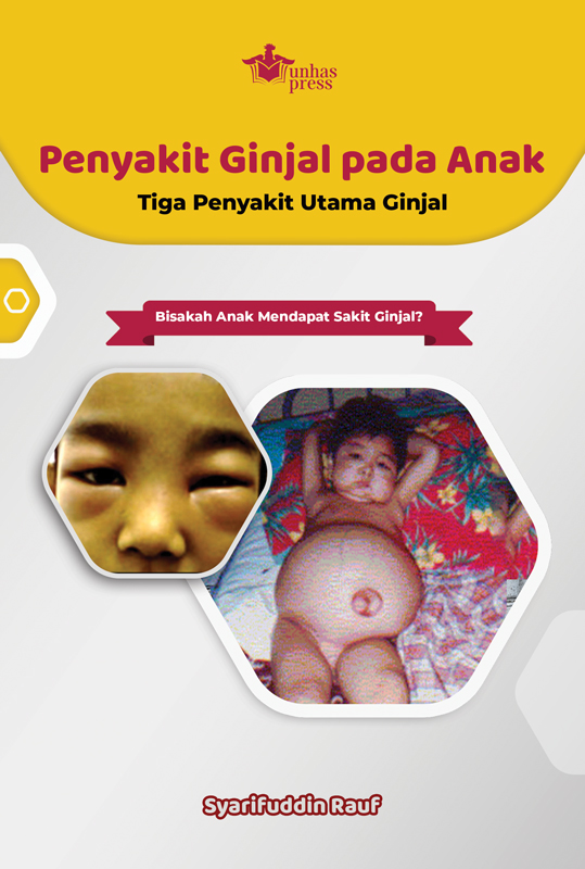 COVER-penyakit-ginjal-anak-A