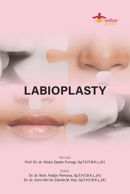 Labioplasty---A